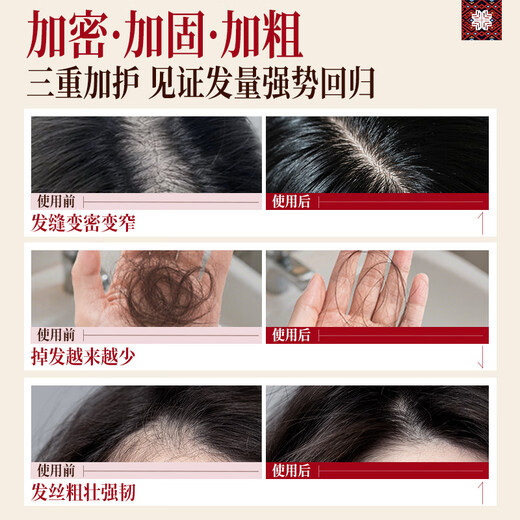 Changfa Xiaozhai Intangible Cultural Heritage & Xinhuanet same style anti-hair loss revitalizing essence 60ml anti-hair loss scalp care solution