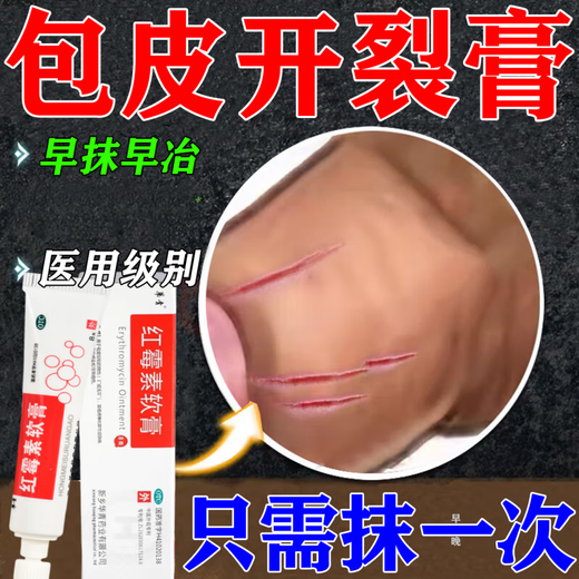Special medicine for healing foreskin crack inflammation. Special medicine for foreskin crack, redness and swelling. Special medicine for balanitis, fungal infection, foreskin infection, pearl rash. Erythromycin ointment 1 box. Redness and swelling of foreskin crack.