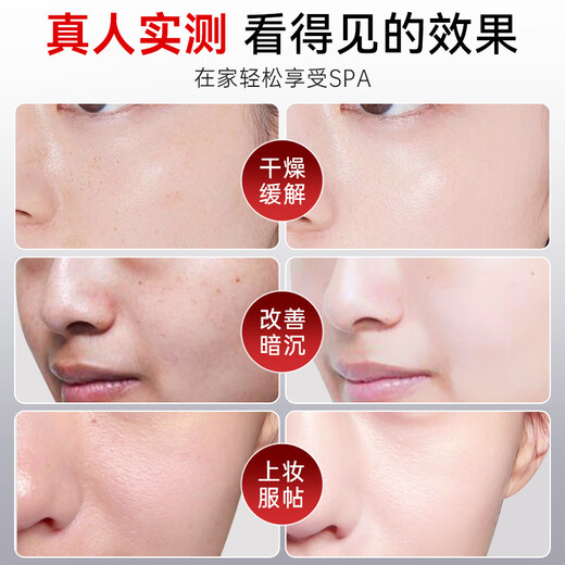 Ou Quanlin High-pressure Oxygen Injection Instrument Nano Spray Hydration Instrument Beauty Instrument Essence Introducer Steam Facial Home Water Light Instrument Upgraded PRO Short Gun Patent High-pressure 5x Penetration + Astaxanthin Double Anti-Response