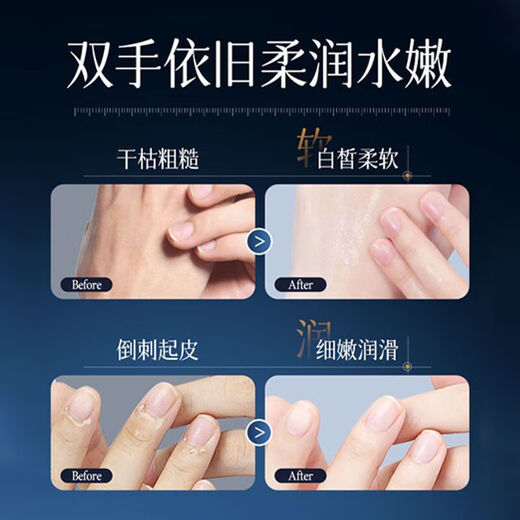 377 Whitening Hand Essence Cream, Rejuvenating and Beautifying Skin, Moisturizing, Whitening and Moisturizing Autumn and Winter Hand Cream, Whitening Hand Cream 80g*3