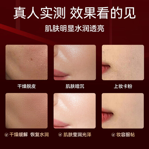 OES Oxygen Injection Instrument Hydration Instrument Humidification Artifact Atomizer Sprayer Water Light Instrument Beauty Instrument Hydrating Whitening Portable Household Facial Steamer Facial Handheld Gift for Girls Star Model Auxiliary Hydration + Powerful Moisturizing + High Pressure Penetration Red