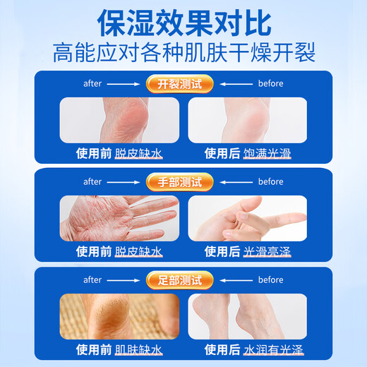 Madeleine Vaseline Double Protective Cream for Chapped Hands and Feet Moisturizer Heel Anti-Crack Moisturizing Moisturizing Cream for Dry Winter Use 40g 1 bottle Vaseline Double Protective Cream