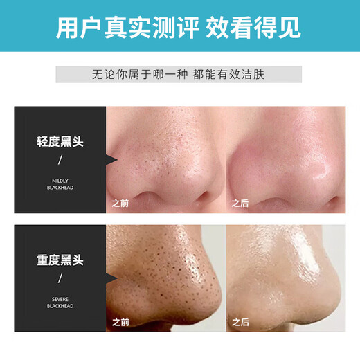 DR.OAKES+DR Bubble Machine Инструмент для чистки лица Средство для удаления черных точек Косметический инструмент для мытья лица Инструмент для глубокого очищения пор для лица Белый