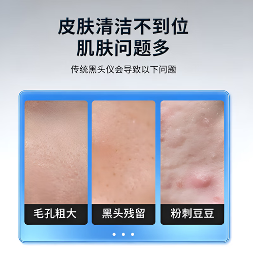 Ningbin German blackhead cleaning artifact visual blackhead suction instrument blackhead suction facial cleanser pore cleaner large suction blackhead suction ice hot compress care beauty instrument cleaning beauty salon same model negative cycle hydrating skin care-deep cleaning-pore shrinking sleeve