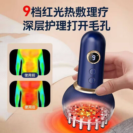 Sawang Germany electric gua sha instrument, cupping all-in-one machine, cupping, walking cup, hot compress to clear abdominal meridians, fully automatic walking cup, unblocking cup, New Year's gift for parents, top charging model, upgraded painless pressure relief, blue + 99 levels of strength
