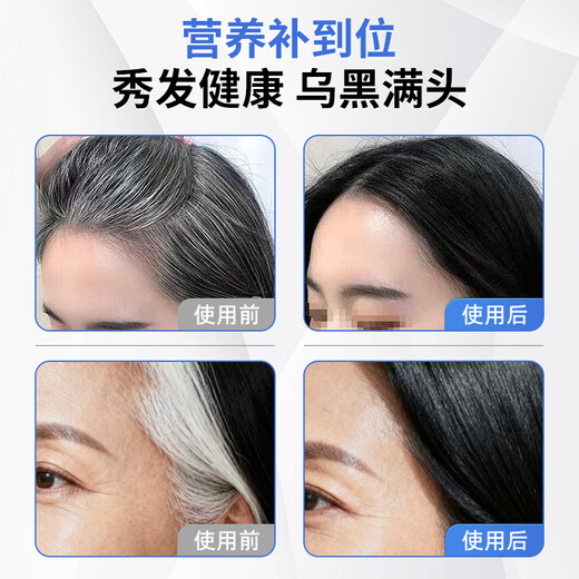 Kangzhengke multivitamin D3 Kangzhengke vitamin B less middle-aged and elderly white hair strong hair roots nourishing hair follicles 2mg*2 box
