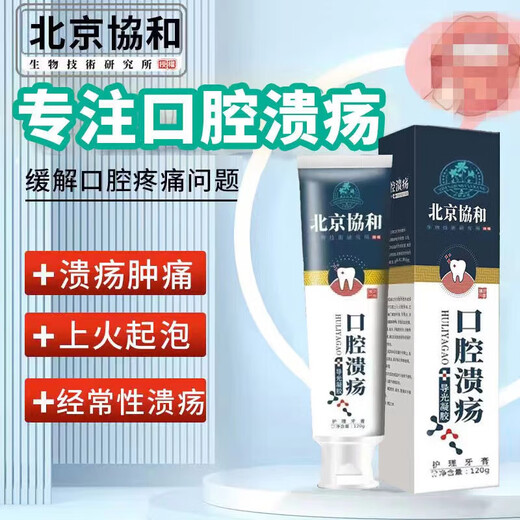 协和北京口腔溃疡用牙膏溃嘴巴起泡修复口腔黏膜上火反复SN1048 三支[疗程装]