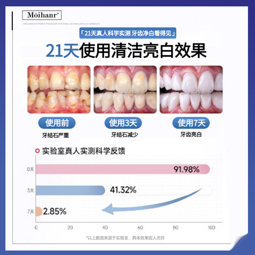 Moihanr German brand whitening toothpaste removes bad breath, yellow, tooth stains, smoke and stains, tartar, top ten well-known products containing fluorine-containing gum protection [2 packs] Long-term care, take away stubborn tooth stains