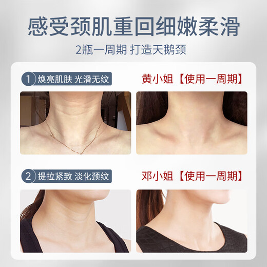 SUMDOY imported Japanese neck cream neck cream anti-wrinkle lifting tightening neck mask neck mask neck care neck care neck cream [Popular recommendation] neck cream 50g + 5 tablets of neck mask
