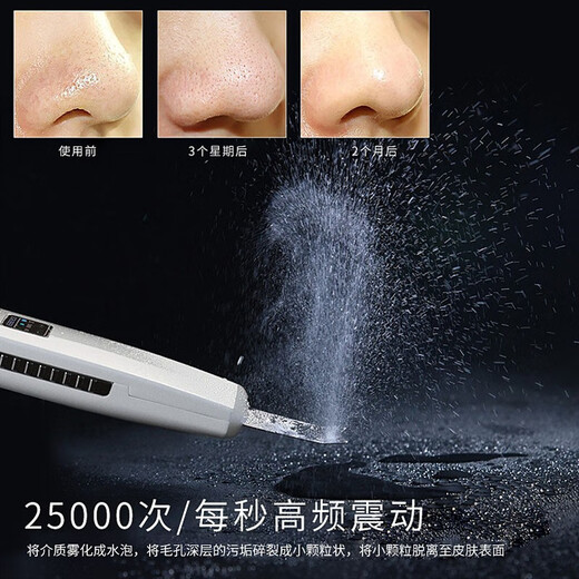 Ultrasonic peeling machine deep cleans pores, removes blackheads, acne, cuticles, and introduces essence facial cleansing device for the face, white