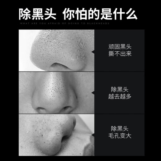 Zunlan Blackhead Removal Nasal Patch Set Peel-off Nasal Mask Mask Unisex Cleans Pores, Removes Acne and Blackheads, Export Liquid to Shrink Pores (Export Liquid + Astringent + Nasal Patch)