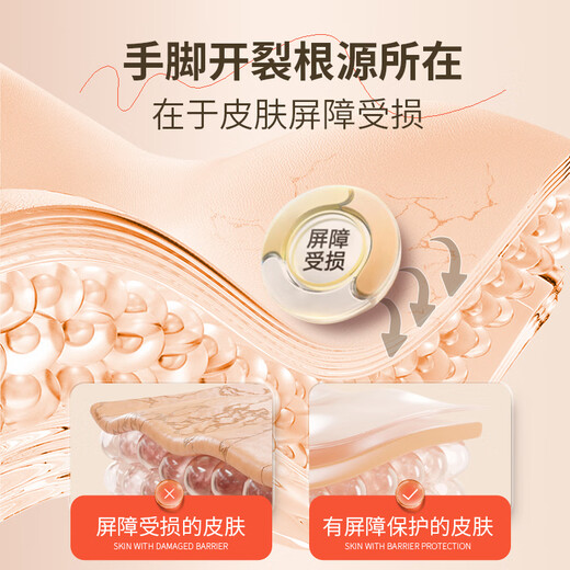 Ice King Cracked Cream 50g Cracked Foot Cream Heel Dry Cracked Peeling Hands and Feet Anti-Crack Cream Hand Cracked Skin Cracked Foot Cream