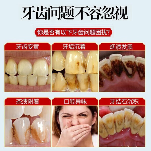 NANJING TONGRENTANG Пивной содовой отбеливающая зубная паста пятна с удалением зуб
