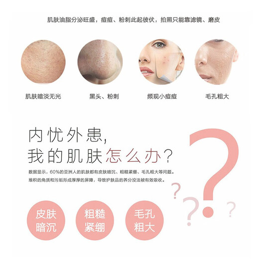 Ultrasonic peeling machine deep cleans pores, removes blackheads, acne, cuticles, and introduces essence facial cleansing device for the face, white