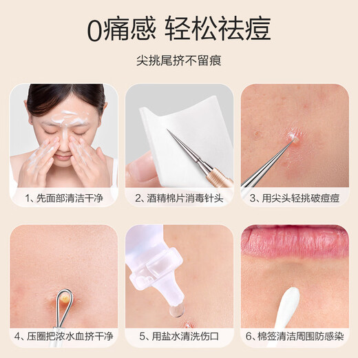 Oeiez acne needle set, cell clip, blackhead removal tweezers, cleaning and acne removal tools, beauty tools, 1 twist cap acne needle