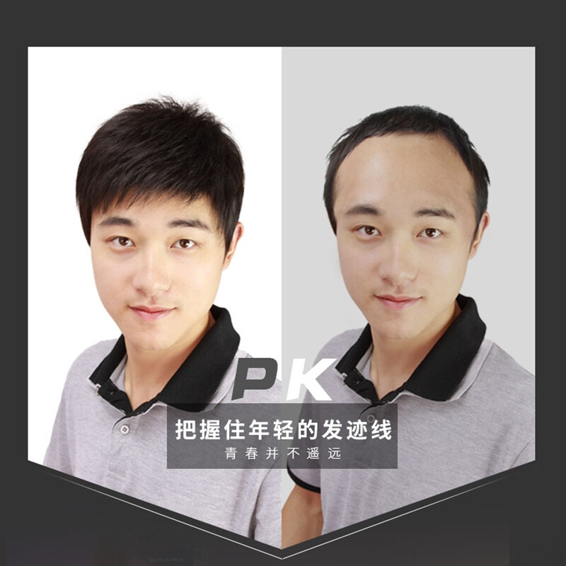 Baisitang wig men's short hair fully hand-woven all around invisible biological scalp head replacement piece full real hair breathable men's hair block