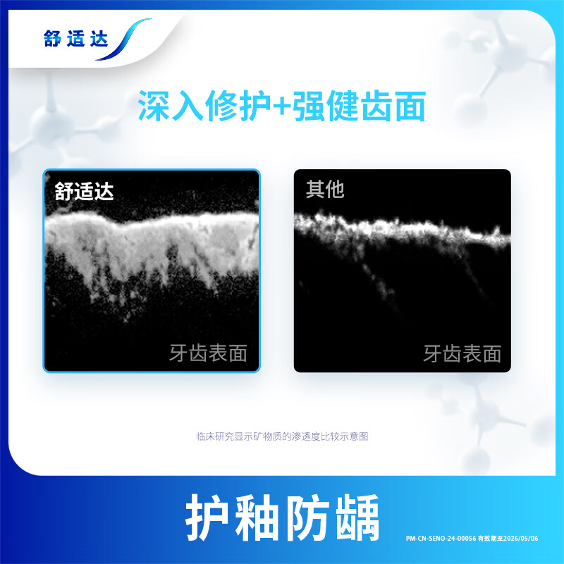 Sensodyne anti-sensitive gum care toothpaste 50g relieves tooth sensitivity and prevents cavities