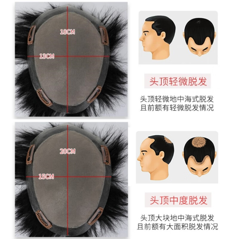 Baisitang wig men's short hair fully hand-woven all around invisible biological scalp head replacement piece full real hair breathable men's hair block