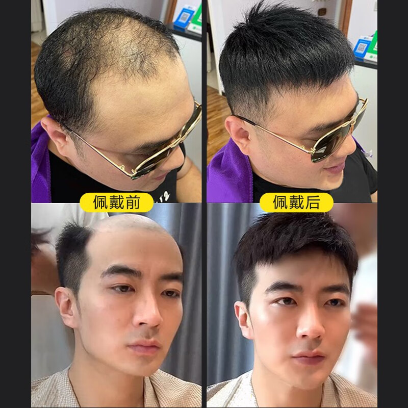 Soul special wig for men with short hair, handsome men's real hair wig, real hair wig piece on top of head, somatosensory net fine repair model 13*18, casual style, natural black