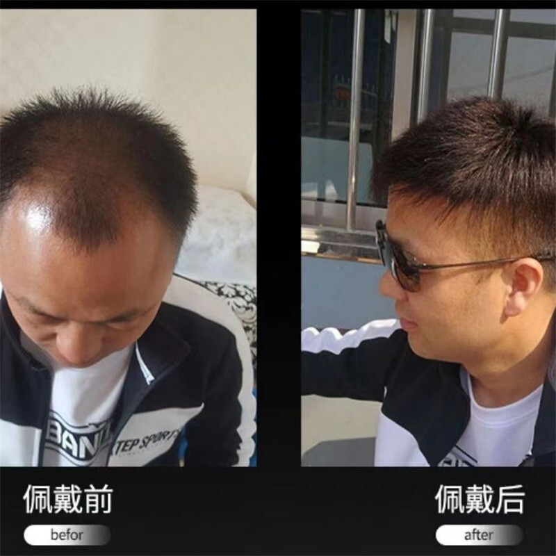 Soul special wig for men with short hair, handsome men's real hair wig, real hair wig piece on top of head, somatosensory net fine repair model 13*18, casual style, natural black