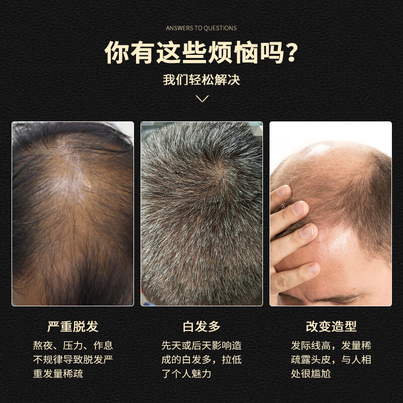 Soul special wig for men with short hair, handsome men's real hair wig, real hair wig piece on top of head, somatosensory net fine repair model 13*18, casual style, natural black