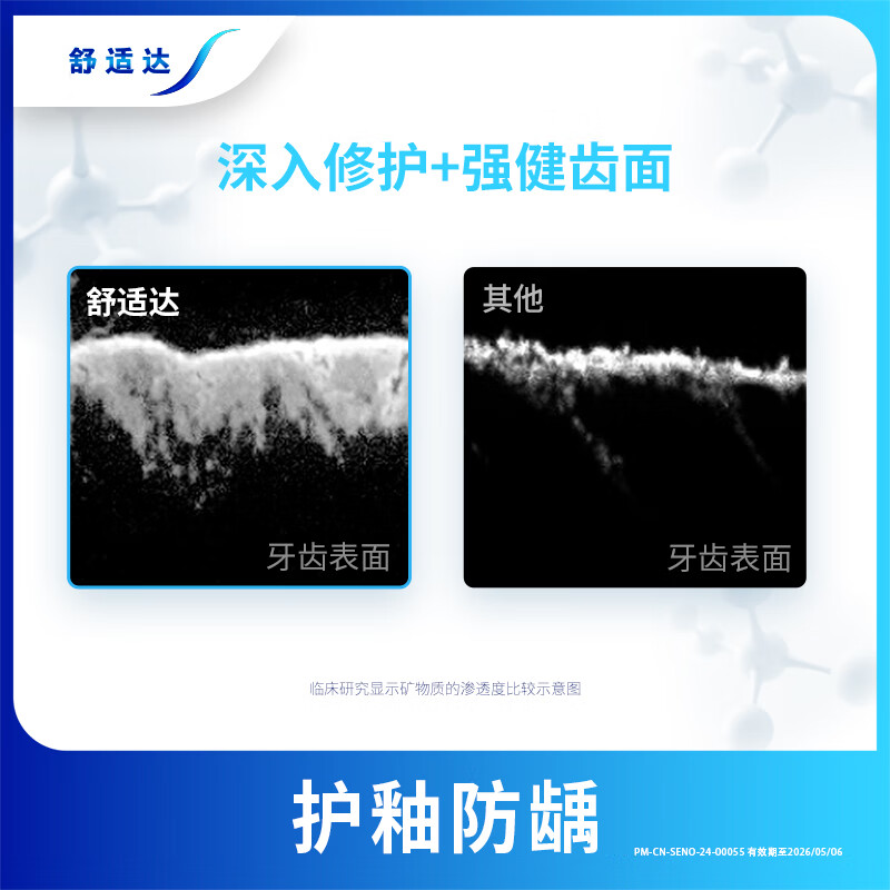 Sensodyne Quick Anti-Sensitive Care Gum Toothpaste 180g*3 new and old packaging sent randomly