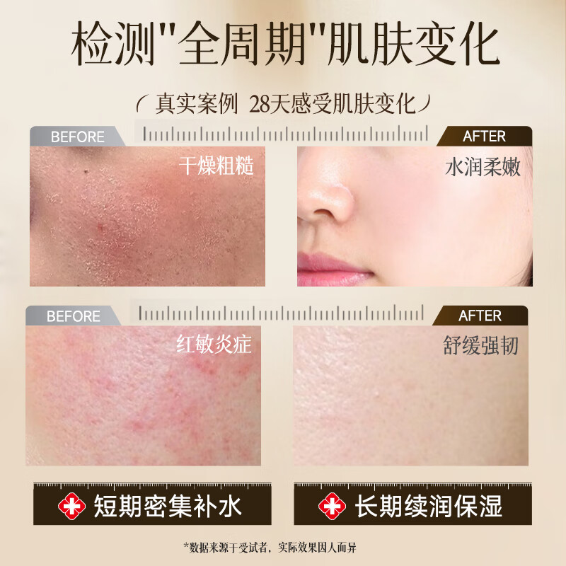 Dyey Astragalus Malaysia Vitamin E Glycerin Skin Care Moisturizing Anti-wrinkle Firming Whole Body Available 350ml New Year Gift