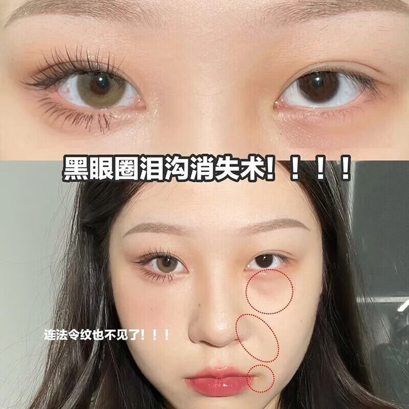 Gemeng three-color concealer concealer palette, shadow highlighter, facial spots, acne marks, dark circles, tear troughs, waterproof, sweat-free powder