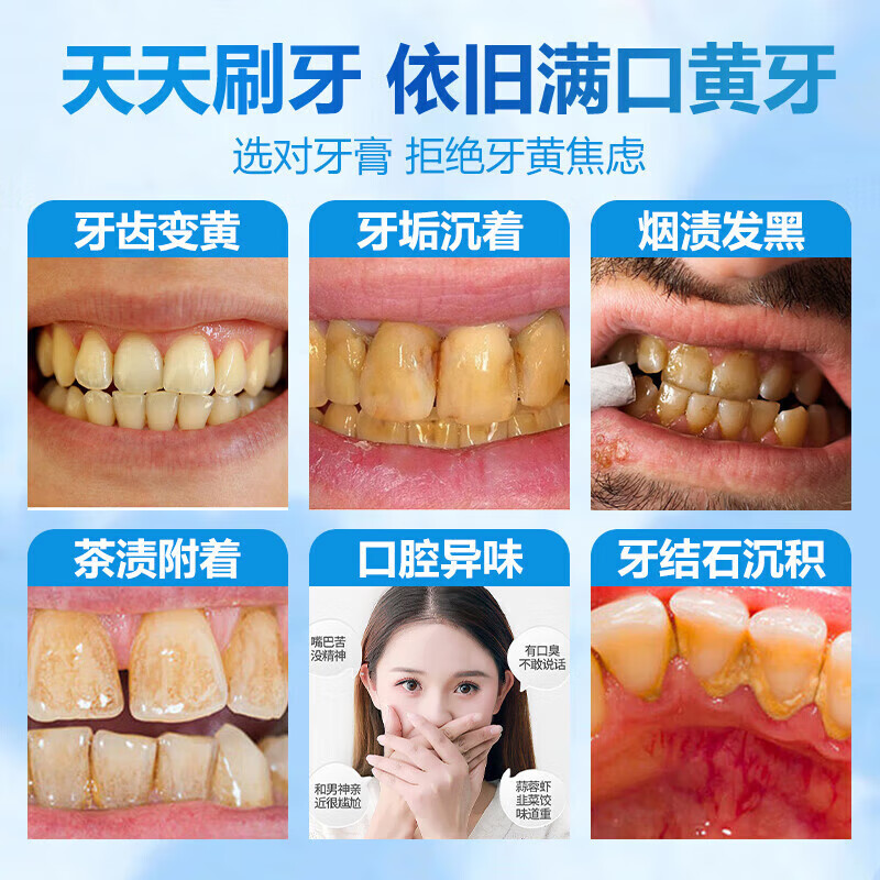 Nanjing Tongrentang Niacinamide Whitening Toothpaste Removes Bad Breath, Removes Yellow Tooth Stains, Removes Smoke Stains, Tartar and Tartar, Whitens and Removes Stains, Freshens Breath. 1 Niacinamide Whitening Toothpaste. Buy more, get more