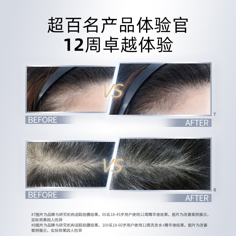 Kangwang Bayer Dr. Lilac Adenosine anti-hair loss essence 75ml revitalizes hair follicles, prevents hair loss, cares for scalp