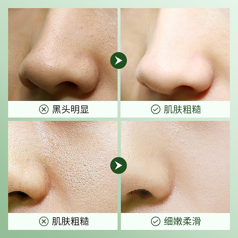 BEAUTY NOTES Centella asiatica water emulsion youth New Year set gift box 12-18 years old hydrating oil control soothing pores boys and girls