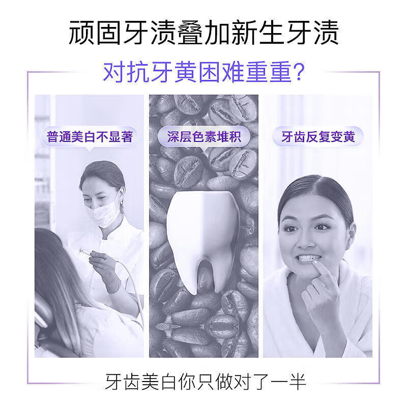 Shuke Diamond Whitening Toothpaste Removes Tooth Stain and Smoke Stains 7 Days White 4 Degrees 120g*2 New and Old Randomly Delivered