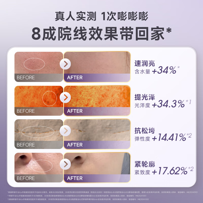 GX Diffuser Guxin water light cannon needle-free water light self-priming water light oxygen injection hydration device home beauty instrument water light introduction device as a birthday gift for girlfriend, mother and wife New Year gift needle-free water light model purple-needle-free water light cannon