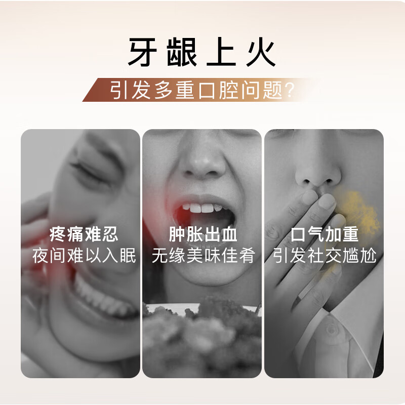 Shuke Zhizhi Gum Nourishing Toothpaste Clears Fire, Improves Gum Repair, Maintains and Anti-Inflammation 120g Moriyama Mint New and Old Randomly