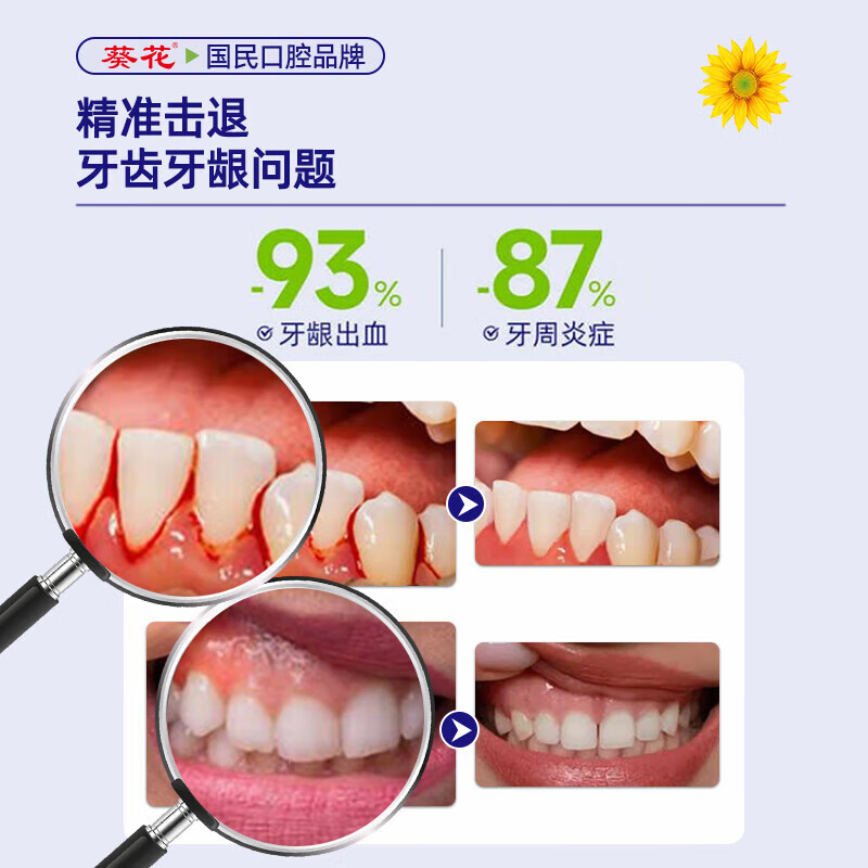 Sunflower desensitizing toothpaste medical fluoride repair gum bleeding special loose teeth solid anti-allergic toothpaste 100*3