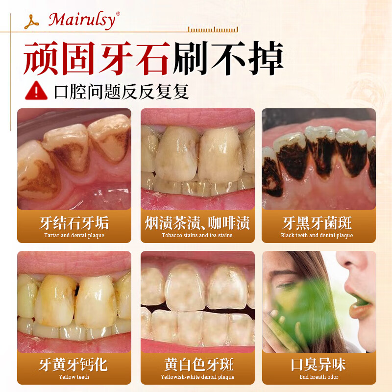 MAIRULSY British special toothpaste for removing calculus, removing bad breath, whitening, removing yellowing, removing tooth stains, removing tobacco stains and removing tartar, No. 1 on the gold list