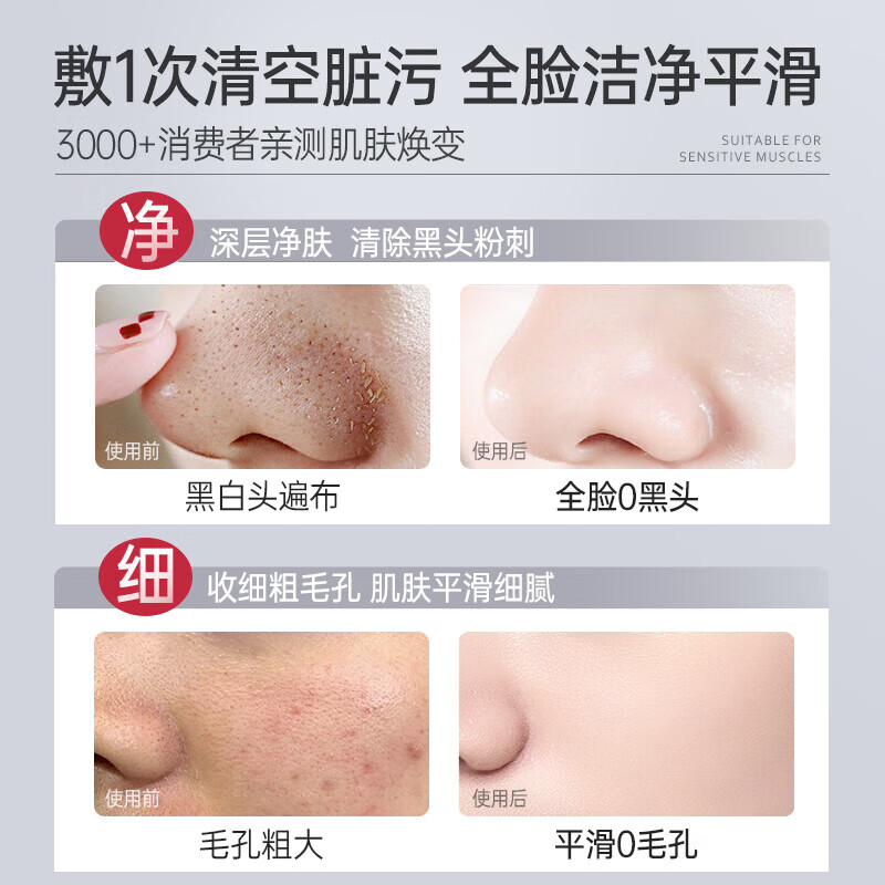 Losoki Swiss imported cleansing mud mask 150g deep cleaning blackhead removal shrink pores acne closed mouth hydrating mask