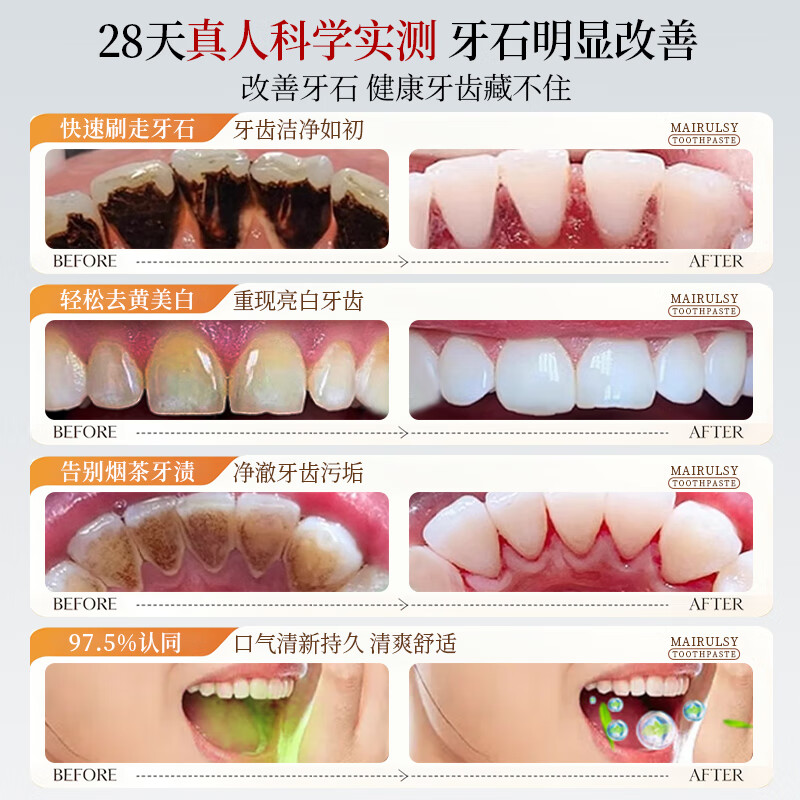 MAIRULSY British special toothpaste for removing calculus, removing bad breath, whitening, removing yellowing, removing tooth stains, removing tobacco stains and removing tartar, No. 1 on the gold list