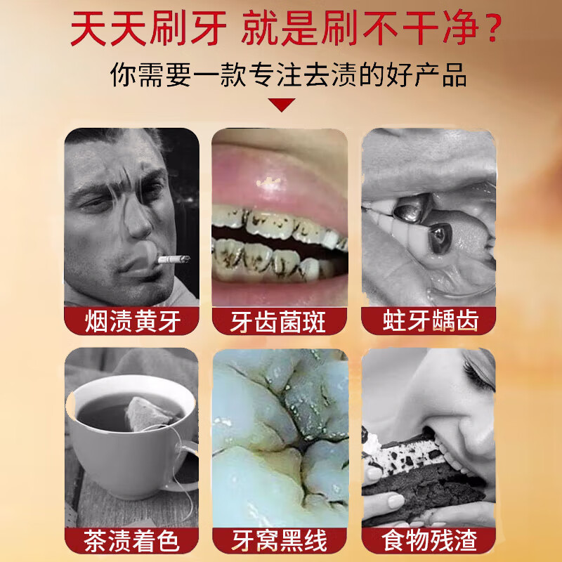 Tooth Champion whitening toothpaste removes plaque, black spots, black lines, pits and fissures, improves tooth yellow and melanin pigmentation artifact