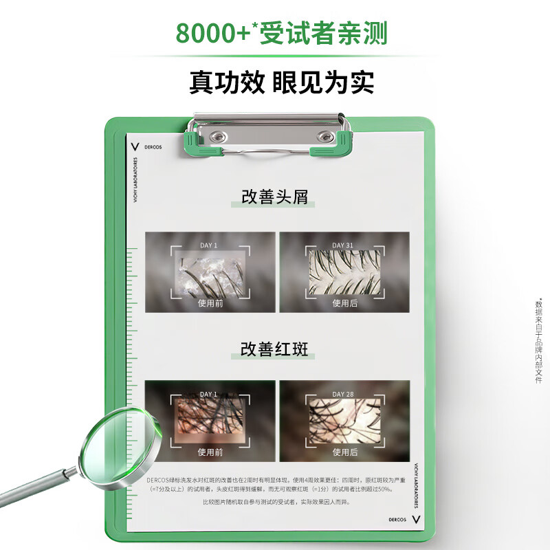 VICHY Anti-Dandruff Shampoo Green Label 1% Selenium Disulfide Relieve Itching, Anti-Dandruff Oil Control Shampoo Popular Product 200ml