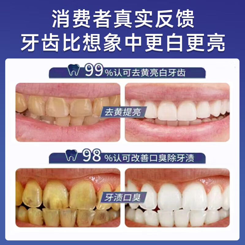 MOIHANR German whitening toothpaste removes yellowing, removes bad breath, brightens, removes tooth stains, smoke stains, tartar, inhibits bacteria, and contains fluoride.