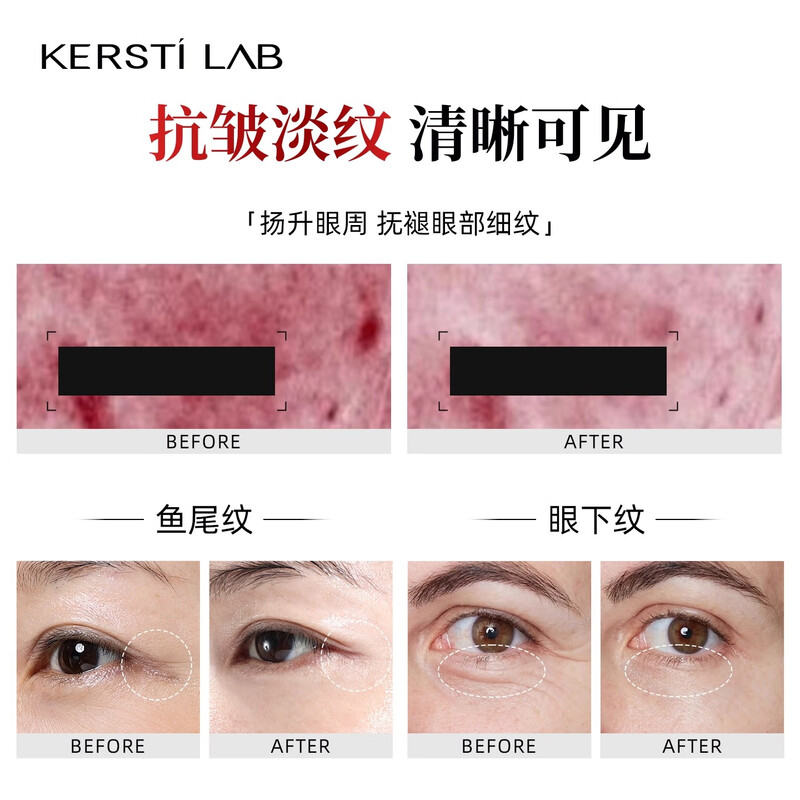 Kastin official Kastin skin care series moisturizing lotion, firming, soothing, brightening skin tone, tightening Kastin elastic anti-wrinkle firming eye cream 25g 1 box, a must-select for good products