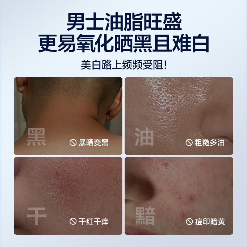 Zunlan men's whitening cream, hydrating and moisturizing lotion, removes spots, brightens skin tone, fades acne marks, men's skin care products 50g