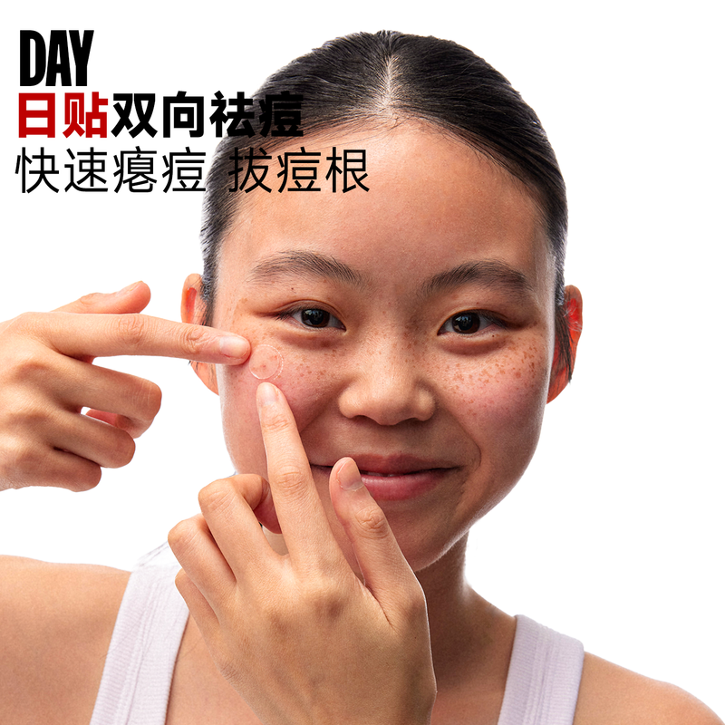 Fufu cleansing and repairing nighttime acne patches, anti-acne, physical suction, pus isolation, pollution, acne removal, acne removal, acne deflation, 36 patches for boys and girls