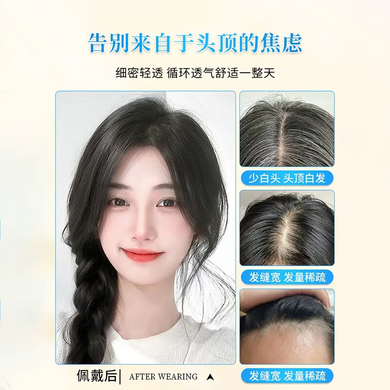Lanting wig for women, real hair on top of head, full human hair, fluffy, natural forehead, light and traceless, covering gray hair, hair replacement patch, butterfly needle net, mocha brown 25cm
