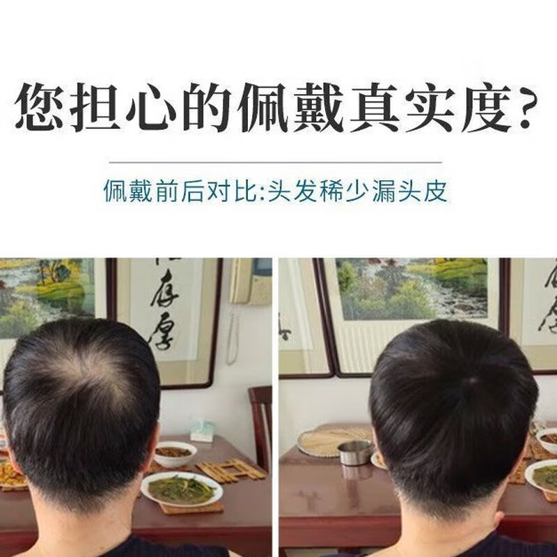 Real hair replacement piece on the top of the head for the elderly to cover gray hair, thin summer style full human hair short hair wig for women to cover baldness, dark brown 9*9, headless hair, short hair