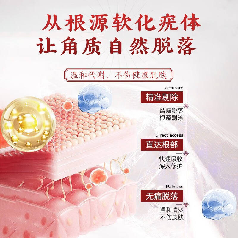 Hong Kong Jing Peitang wart and mole removal soap, small fleshy particles all over the body, flat neck, especially filamentous warts, antibacterial, wart removal, fly feces soap