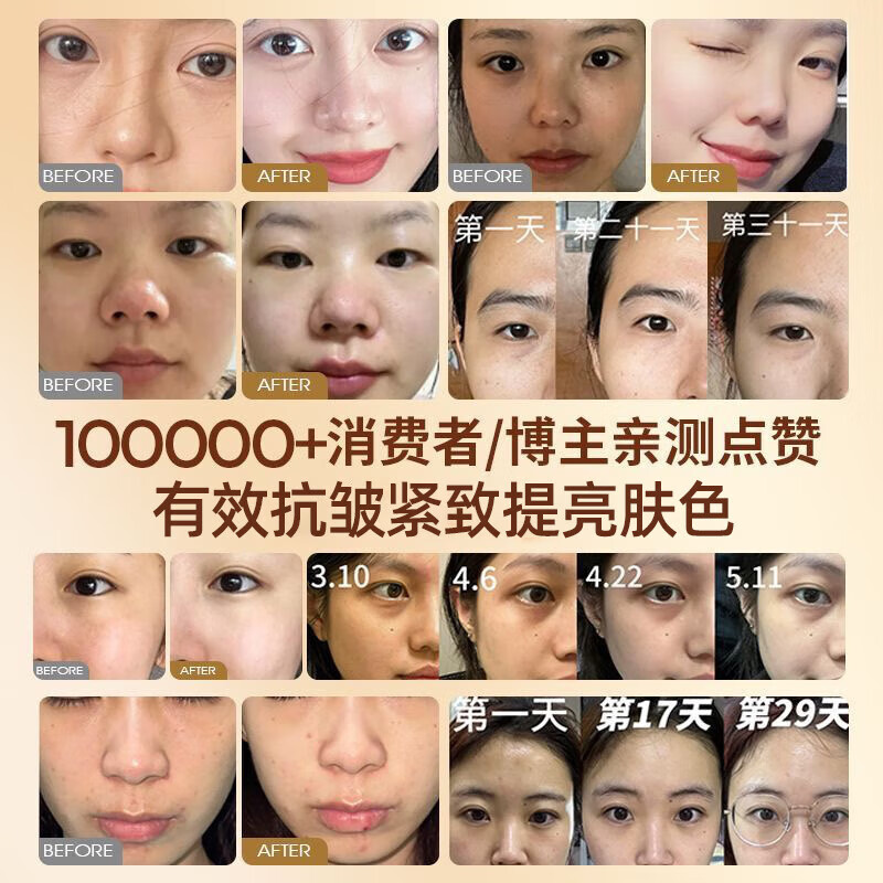 BEAI French Rose Essence Oil Anti-wrinkle Aging Firming Oil Nourish Skin Remove Yellow Face Face Lift Light Lines 2 Bottles for Men and Women