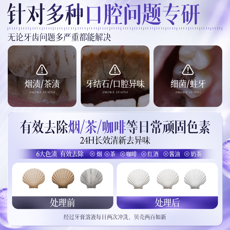 Ailan Gona toothpaste removes yellow, removes tobacco stains, removes tartar, removes bad breath, oral antibacterial, protects gums, repairs, whitens and fluoride-free toothpaste 180g