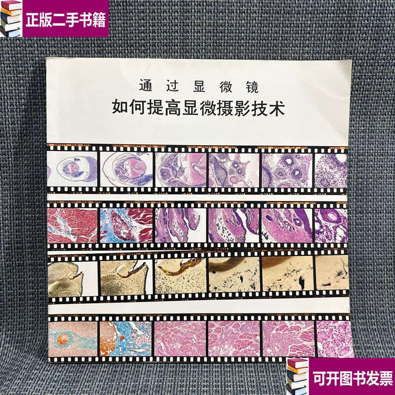 90% new second-hand through microscope How to improve microphotography technology / Editorial Board Editorial Board